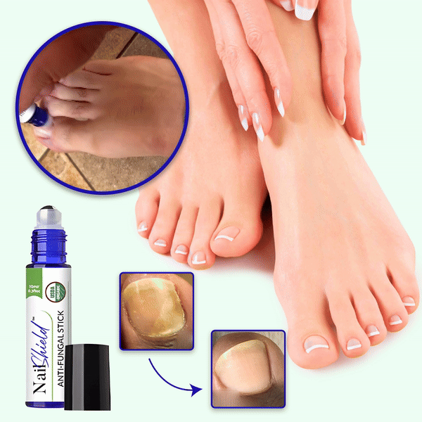 NailShield™ Anti Fungal Stick | Zeg Vaarwel tegen Nagelschimmel in Slechts 5 Dagen!