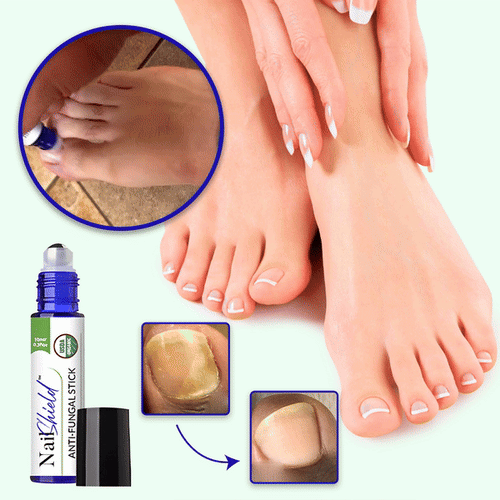 NailShield™ Anti Fungal Stick | Zeg Vaarwel tegen Nagelschimmel in Slechts 5 Dagen!
